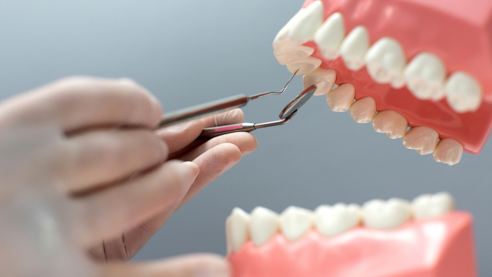 Implant-Supported Dentures